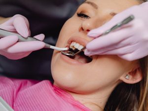 Removing Dental Calculus