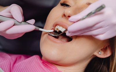 5 Tips for Preventing and Removing Dental Calculus